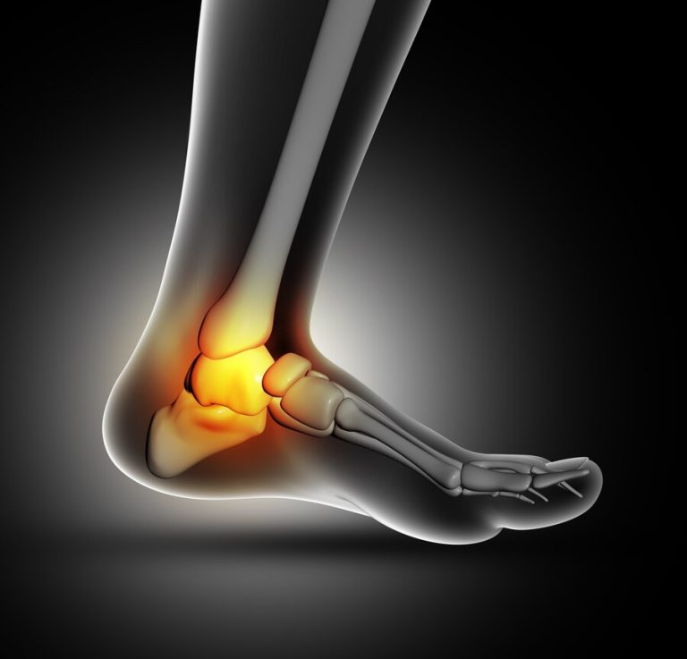 Cartilage repair in Ankle joint
