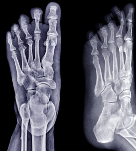 Foot and Ankle Surgery